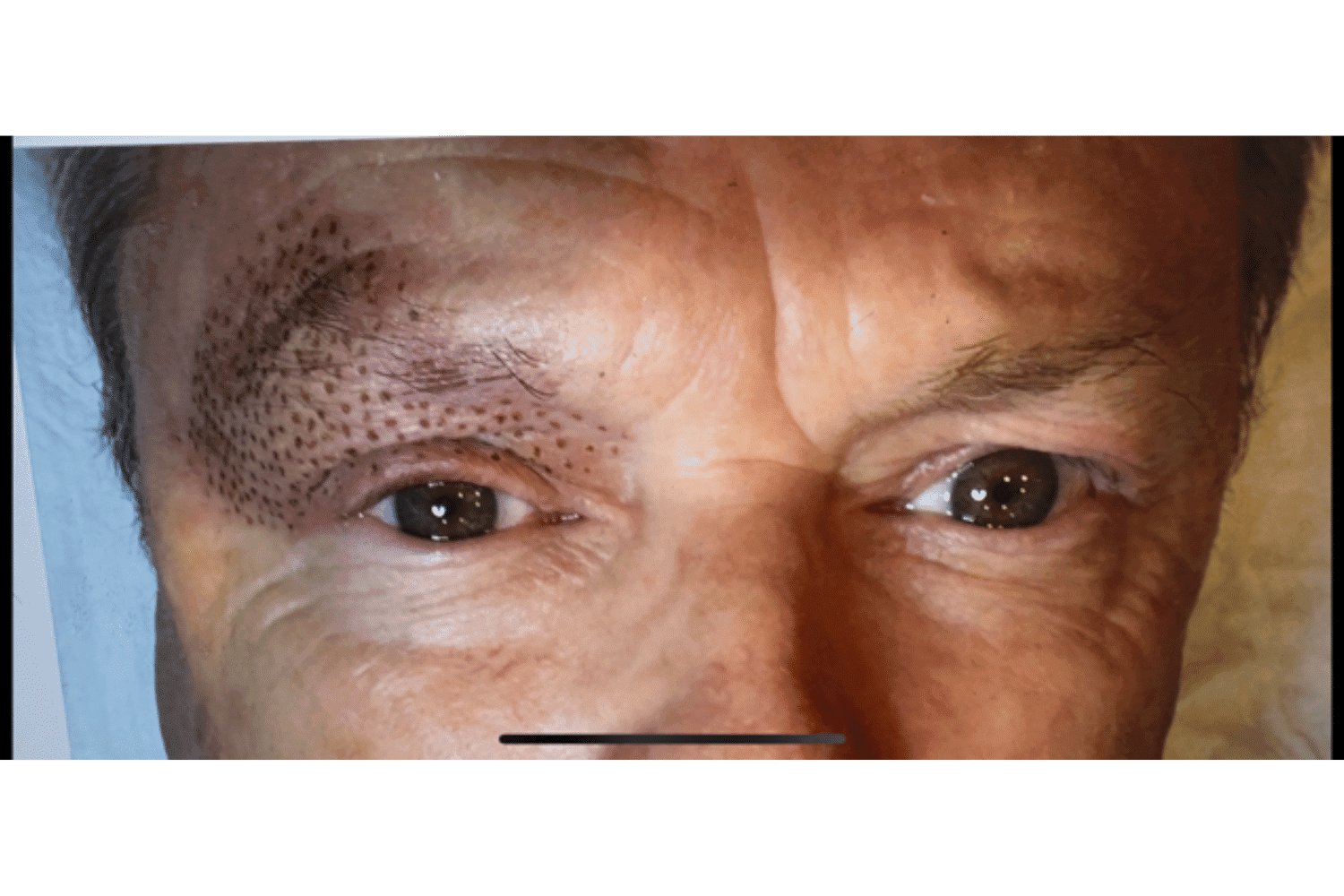 Close-up of a person's face showing microblading or tattooed eyebrows.